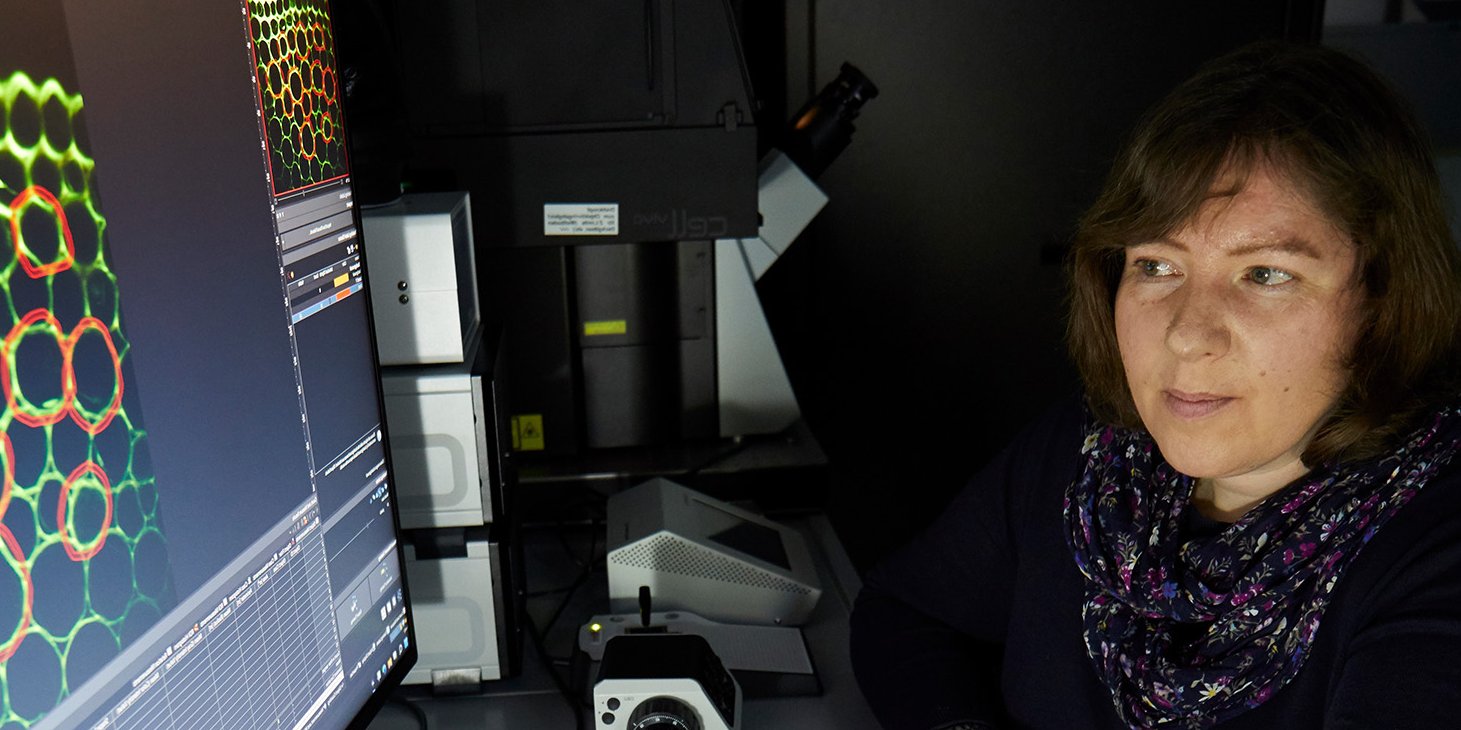 Dr. Petra Neumann-Staubitz am Arbeitsplatz im Labor vor einem Bildschirm mit einer Mikroskopaufnahme von bunt eingefärbtem Zellgewebe 